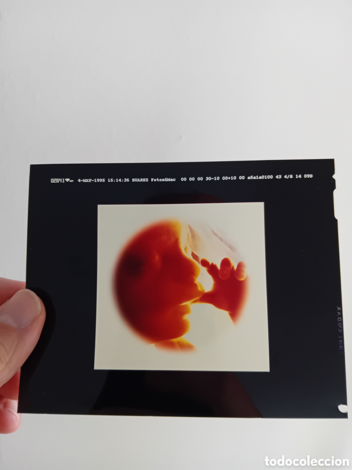 Fotograf&iacute;a antigua: DIAPO PLACA MEDIO FORMATO BEBE FETO. 1995