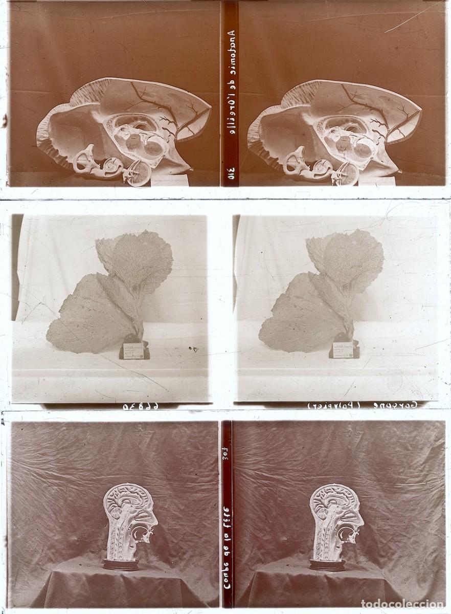 Fotograf&iacute;a antigua: ANATOMIA LOTE 10 POSITIVOS DE CRISTAL FORMATO 6 X 13 CM.
