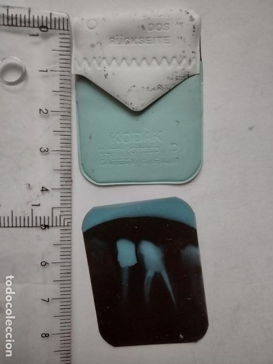 Fotograf&iacute;a antigua: RADIOGRAF&Iacute;A KODAK , DIENTE MUELA MOLAR - FINALES 80 ,