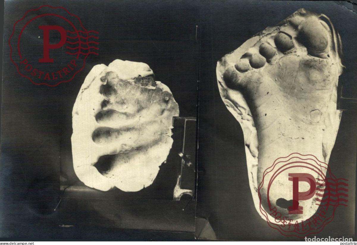 Fotograf&iacute;a antigua: 6 TOES FOOTPRINT 15*11CM