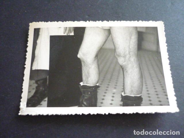 Fotograf&iacute;a antigua: FOTOGRAFIA MALFORMACION FISICA POR EL DOCTOR GARAIZABAL A&Ntilde;OS 40 ANTIGUA FOTOGRAFIA 6 X 9 CM