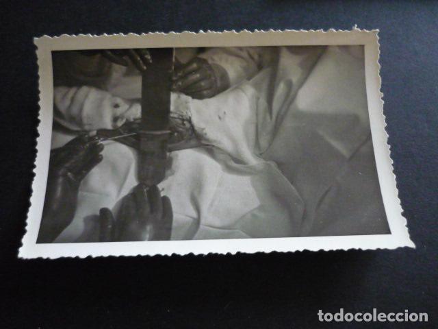 Fotograf&iacute;a antigua: FOTOGRAFIA MALFORMACION FISICA POR EL DOCTOR GARAIZABAL A&Ntilde;OS 40 ANTIGUA FOTOGRAFIA 6 X 9 CM