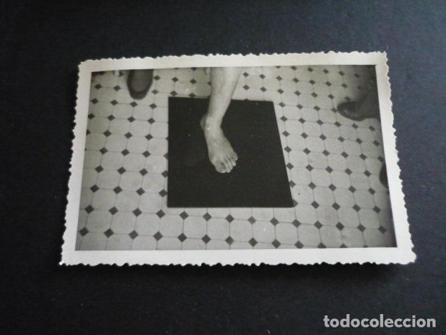 Alte Fotografie: FOTOGRAFIA MALFORMACION FISICA POR EL DOCTOR GARAIZABAL A&Ntilde;OS 40 ANTIGUA FOTOGRAFIA 6 X 9 CM