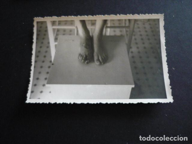Fotograf&iacute;a antigua: FOTOGRAFIA MALFORMACION FISICA POR EL DOCTOR GARAIZABAL A&Ntilde;OS 40 ANTIGUA FOTOGRAFIA 6 X 9 CM