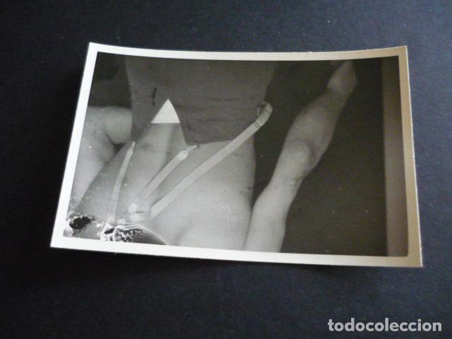 Fotograf&iacute;a antigua: FOTOGRAFIA MALFORMACION FISICA POR EL DOCTOR GARAIZABAL A&Ntilde;OS 40 ANTIGUA FOTOGRAFIA 6 X 9 CM
