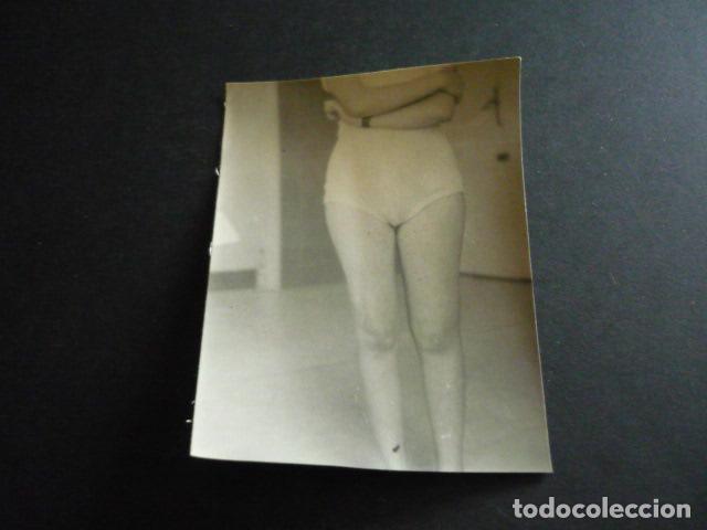 Alte Fotografie: FOTOGRAFIA MALFORMACION FISICA POR EL DOCTOR GARAIZABAL A&Ntilde;OS 40 ANTIGUA FOTOGRAFIA 6 X 9 CM