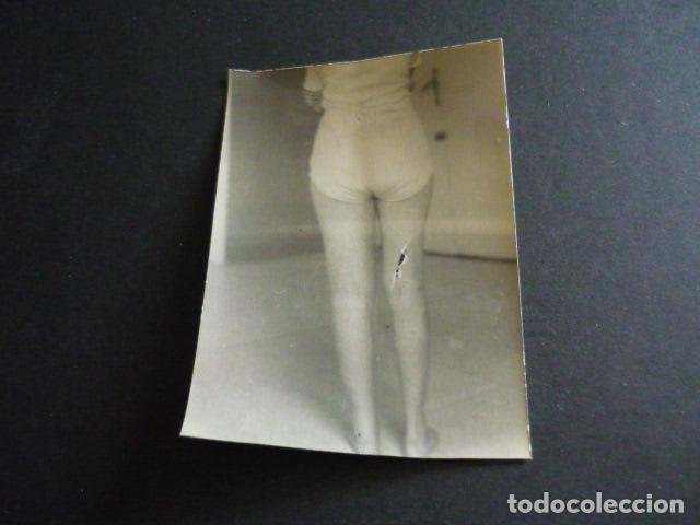 Fotograf&iacute;a antigua: FOTOGRAFIA MALFORMACION FISICA POR EL DOCTOR GARAIZABAL A&Ntilde;OS 40 ANTIGUA FOTOGRAFIA 6 X 9 CM