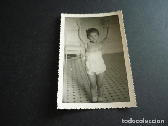 Fotograf&iacute;a antigua: FOTOGRAFIA MALFORMACION FISICA POR EL DOCTOR GARAIZABAL A&Ntilde;OS 40 ANTIGUA FOTOGRAFIA 6 X 9 CM