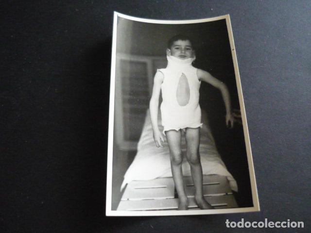 Fotograf&iacute;a antigua: FOTOGRAFIA MALFORMACION FISICA POR EL DOCTOR GARAIZABAL A&Ntilde;OS 40 ANTIGUA FOTOGRAFIA 6 X 9 CM
