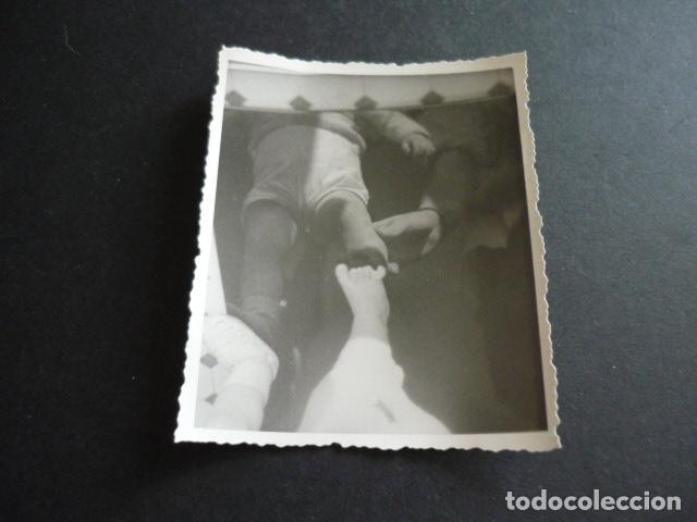 Alte Fotografie: FOTOGRAFIA MALFORMACION FISICA POR EL DOCTOR GARAIZABAL A&Ntilde;OS 40 ANTIGUA FOTOGRAFIA 6 X 9 CM
