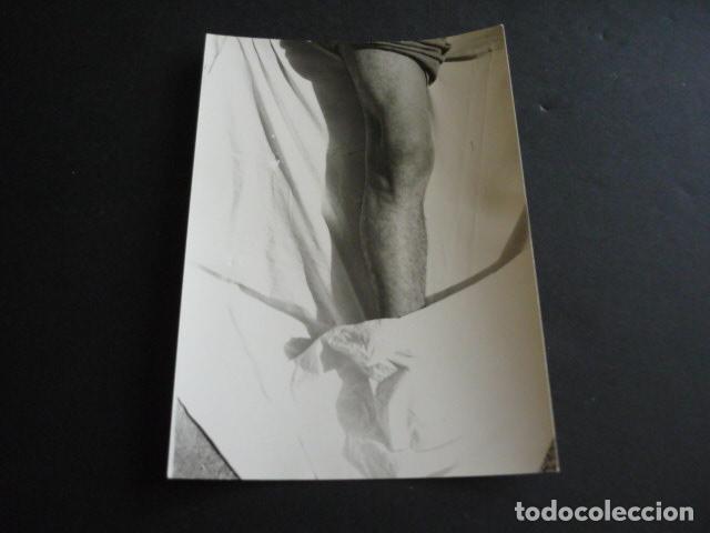 Fotograf&iacute;a antigua: FOTOGRAFIA MALFORMACION FISICA POR EL DOCTOR GARAIZABAL A&Ntilde;OS 40 ANTIGUA FOTOGRAFIA 7,5 X 10,5 CM