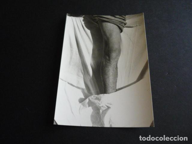 Fotograf&iacute;a antigua: FOTOGRAFIA MALFORMACION FISICA POR EL DOCTOR GARAIZABAL A&Ntilde;OS 40 ANTIGUA FOTOGRAFIA 7,5 X 10,5 CM
