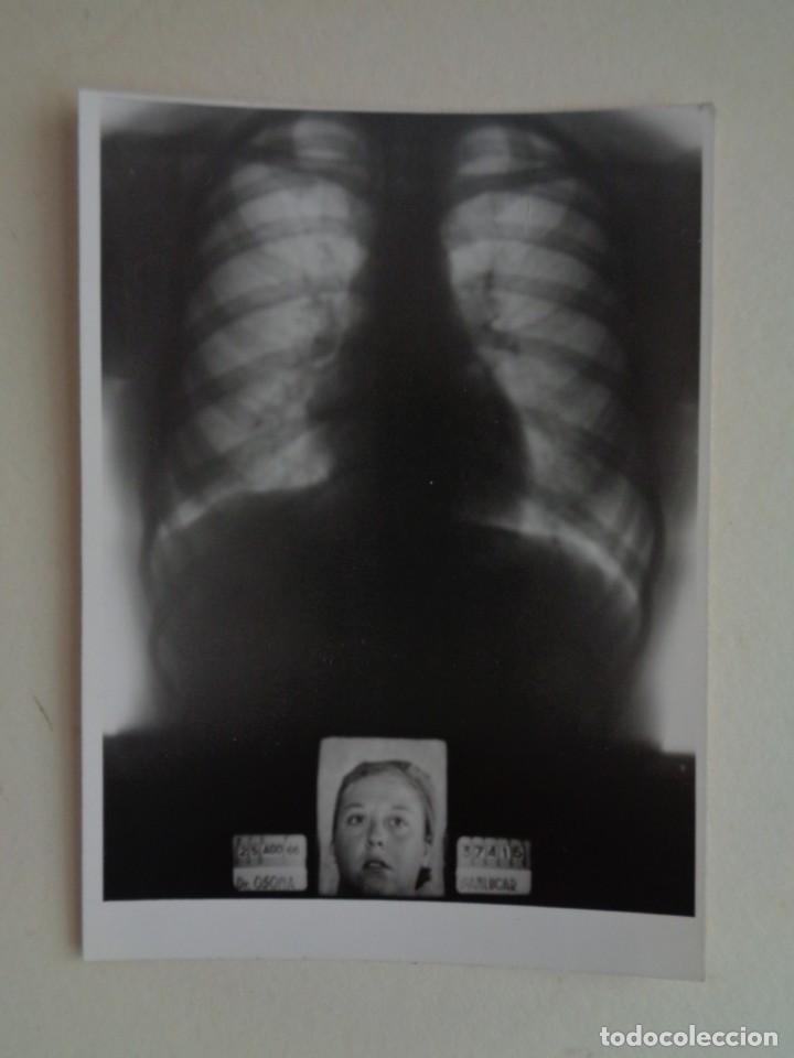 Alte Fotografie: FOTOMONTAJE DE RADIOGRAFIA DE TORAX Y RETRATO DEL NI&Ntilde;O . SANLUCAR , 1966