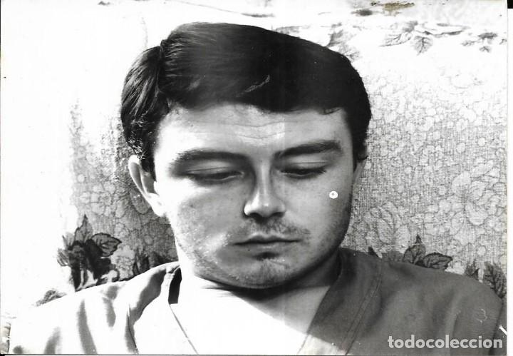 Alte Fotografie: == NA686 - FOTOGRAFIA - FOTO DE JOVEN DEFECTUOSA