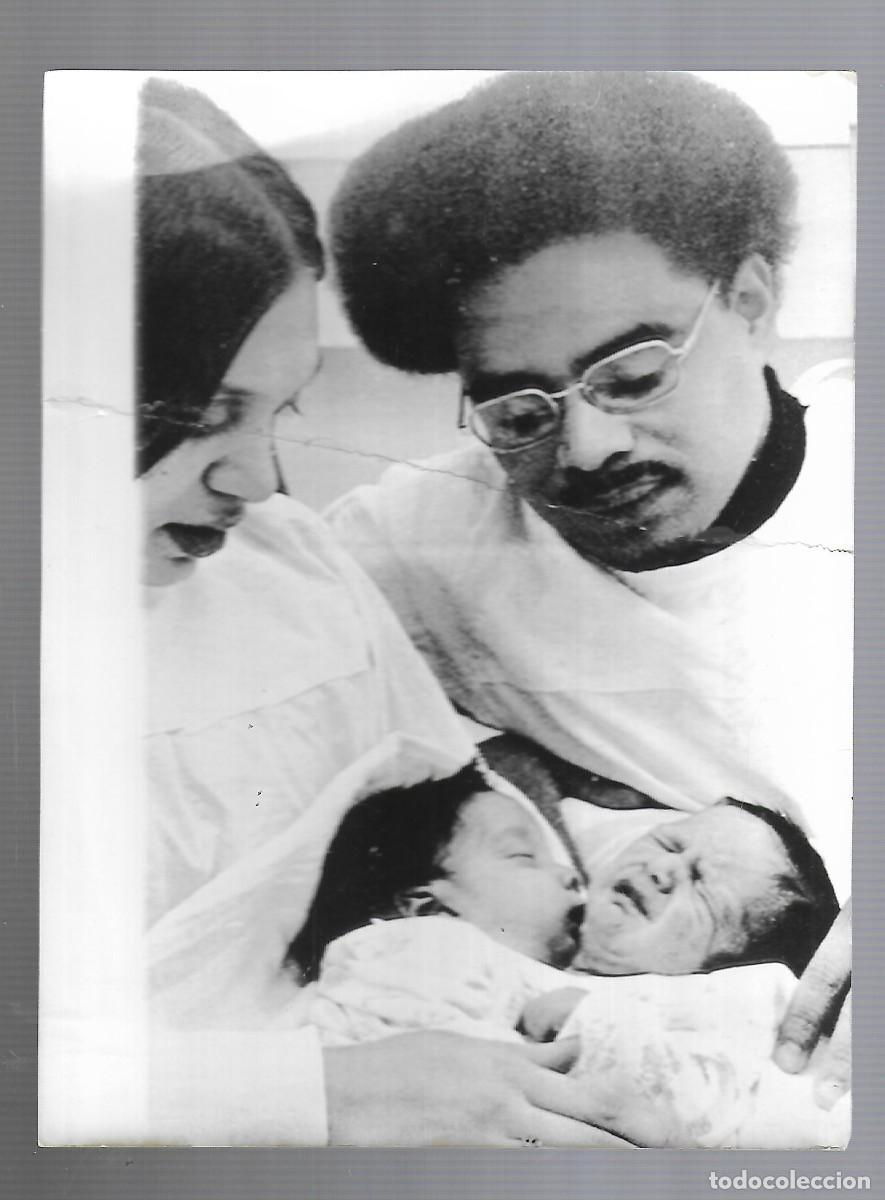 Fotografia antiga: OHIO 2-3-78 DOS NI&Ntilde;OS GEMELOS NACEN UNIDOS POR EL ABDOMEN CON UN CORAZON VER DORSO