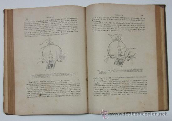 Libros antiguos: GINECOLOGIA - A&Ntilde;O 1898 - Foto 4