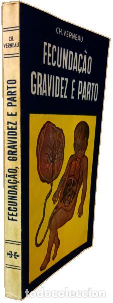 Libros antiguos: VERNEAU. (Ch.) - FECUNDA&Ccedil;&Atilde;O, GRAVIDEZ E PARTO. - Foto 4
