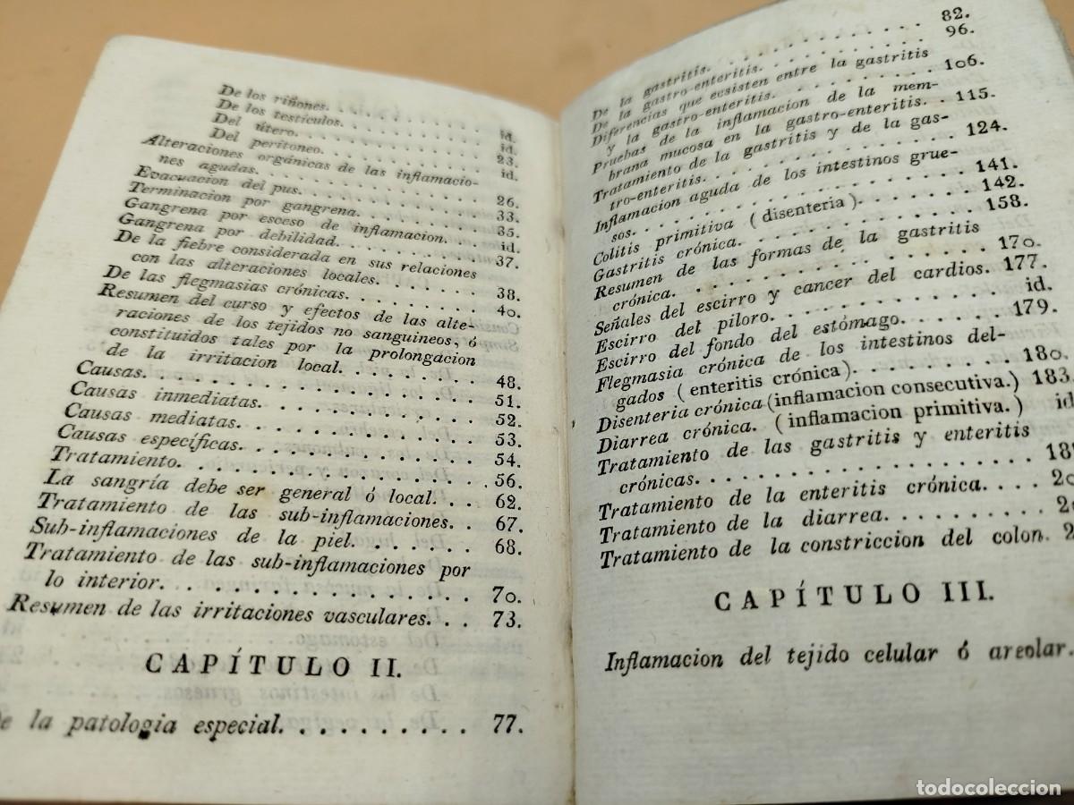 Libros antiguos: LECCIONES DEL DOCTOR BROUSSAIS 1827 - Foto 9