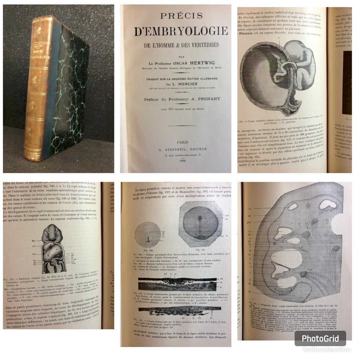 Libros antiguos: Lote com 2 exemplares com o tema: Embriologia humana. Raros. POSSO VENDER EM SEPARADO