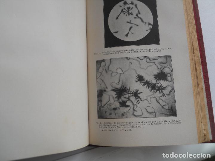 Libros antiguos: TRATADO DE MEDICINA LEGAL L. THOINOT DOS VOLUMENES AÑO 1916 - Foto 7 - 111535803
