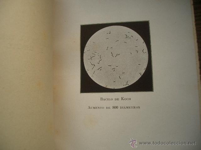 Libros antiguos: Tuberculosis - Foto 7