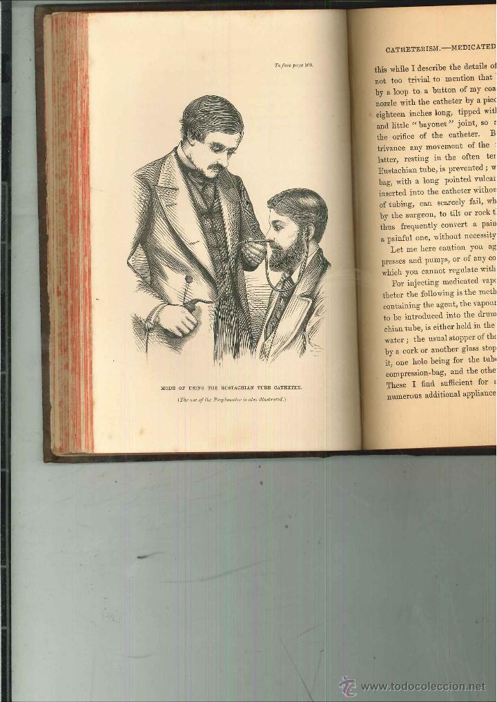 Libros antiguos: LECTURES ON AURAL CATARRH. Peter Allen - Foto 3