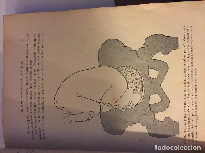 Libros antiguos: partos, curioso libro de obstetricia - Foto 3