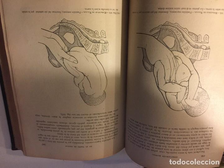 Libros antiguos: partos, curioso libro de obstetricia - Foto 4