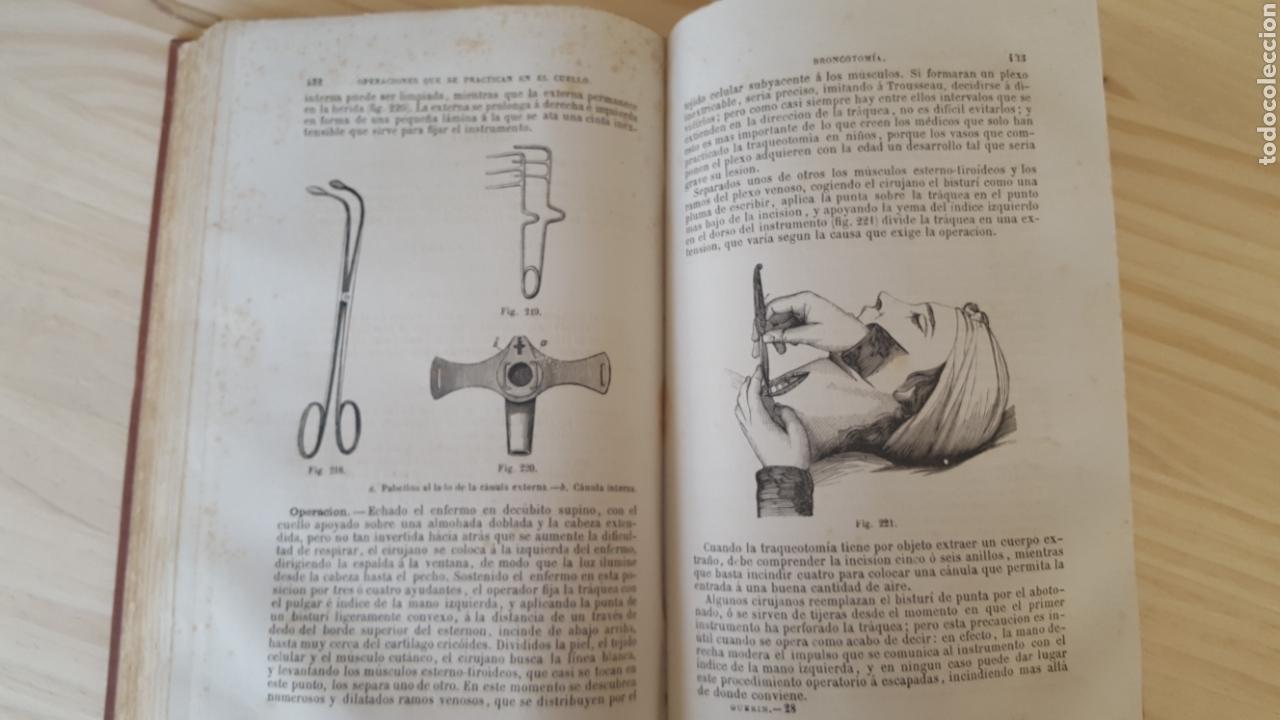 Libros antiguos: Elementos de cirug&iacute;a operatoria. O Tratado pr&aacute;ctico de las operaciones. - Foto 4