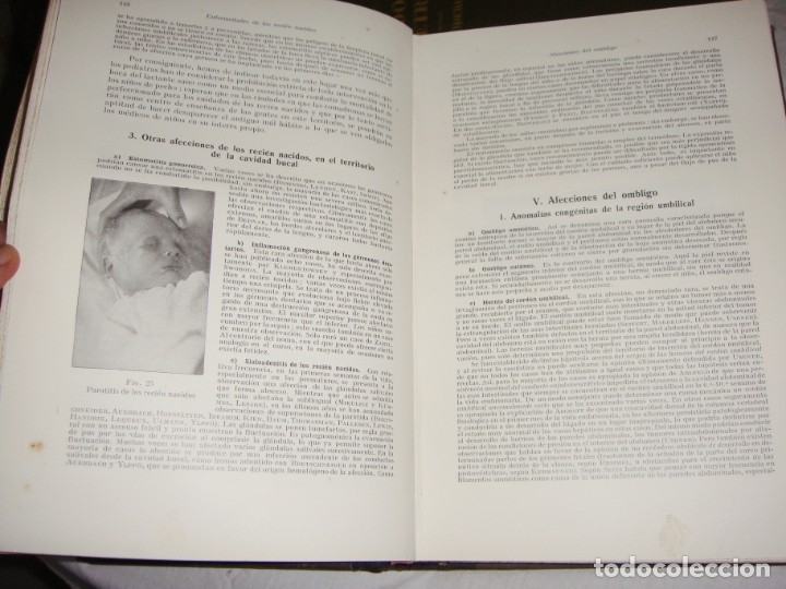 Libros antiguos: Tratado de Obstetricia &middot; Prof. A. D&ouml;derlein &middot; Tomos I, III y IV &middot; Ilustrado &middot; 1925 - Foto 3