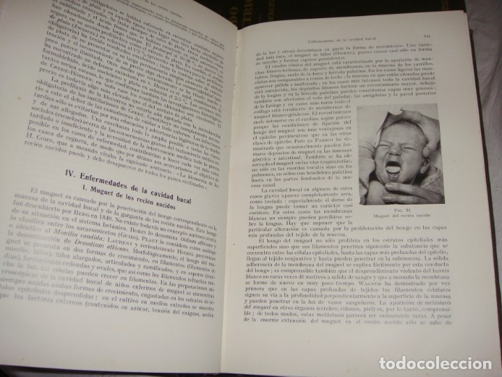 Libros antiguos: Tratado de Obstetricia &middot; Prof. A. D&ouml;derlein &middot; Tomos I, III y IV &middot; Ilustrado &middot; 1925 - Foto 4