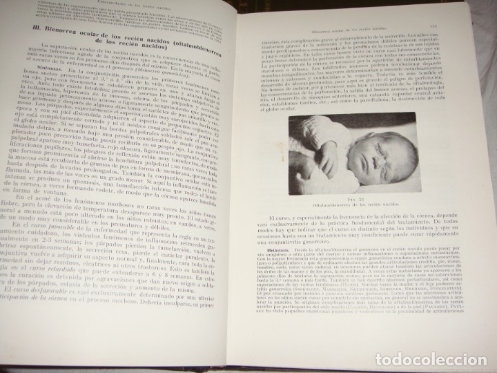 Libros antiguos: Tratado de Obstetricia &middot; Prof. A. D&ouml;derlein &middot; Tomos I, III y IV &middot; Ilustrado &middot; 1925 - Foto 5