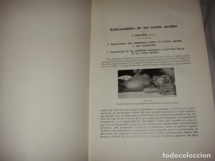 Libros antiguos: Tratado de Obstetricia &middot; Prof. A. D&ouml;derlein &middot; Tomos I, III y IV &middot; Ilustrado &middot; 1925 - Foto 6