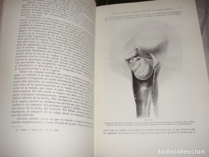 Libros antiguos: Tratado de Obstetricia &middot; Prof. A. D&ouml;derlein &middot; Tomos I, III y IV &middot; Ilustrado &middot; 1925 - Foto 7