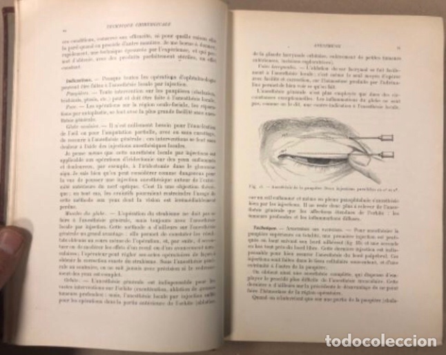 Libros antiguos: TRAITÉ D’OPHTALMOLOGIE TOME I. POULARD. MASSON ET CIE EDITEURS 1923. TRATADO DE OFTALMOLOGÍA - Foto 4 - 208796648