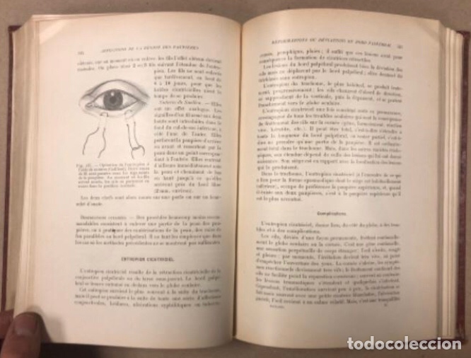 Libros antiguos: TRAITÉ D’OPHTALMOLOGIE TOME I. POULARD. MASSON ET CIE EDITEURS 1923. TRATADO DE OFTALMOLOGÍA - Foto 10 - 208796648