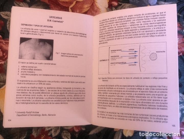 Libros antiguos: MANUAL DE ALERGIA. UCB. 1992 - Foto 6