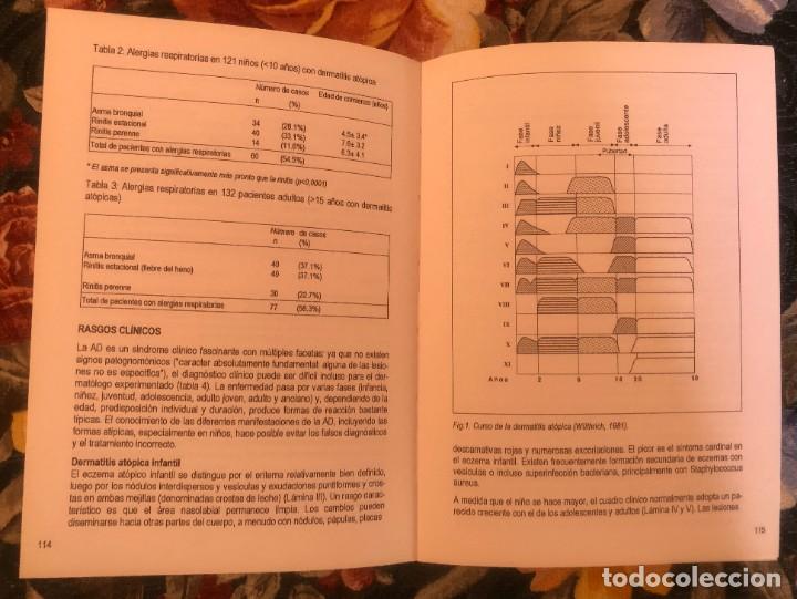 Libros antiguos: MANUAL DE ALERGIA. UCB. 1992 - Foto 7