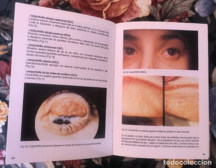 Libros antiguos: MANUAL DE ALERGIA. UCB. 1992 - Foto 9