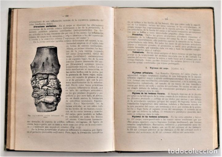 Libros antiguos: COMPENDIO DE PATOLOGÍA QUIRÚRGICA PARA VETERINARIOS - FRÖHNER Y EBERLEIN - BARCELONA AÑO 1922 - Foto 8 - 214321377