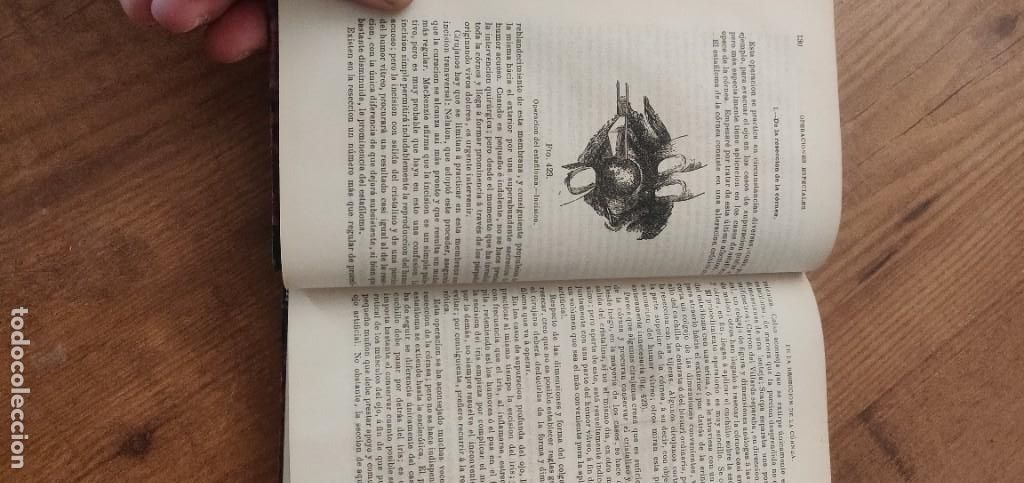Libros antiguos: MANUAL DE MEDICINA OPERATORIA - Foto 3