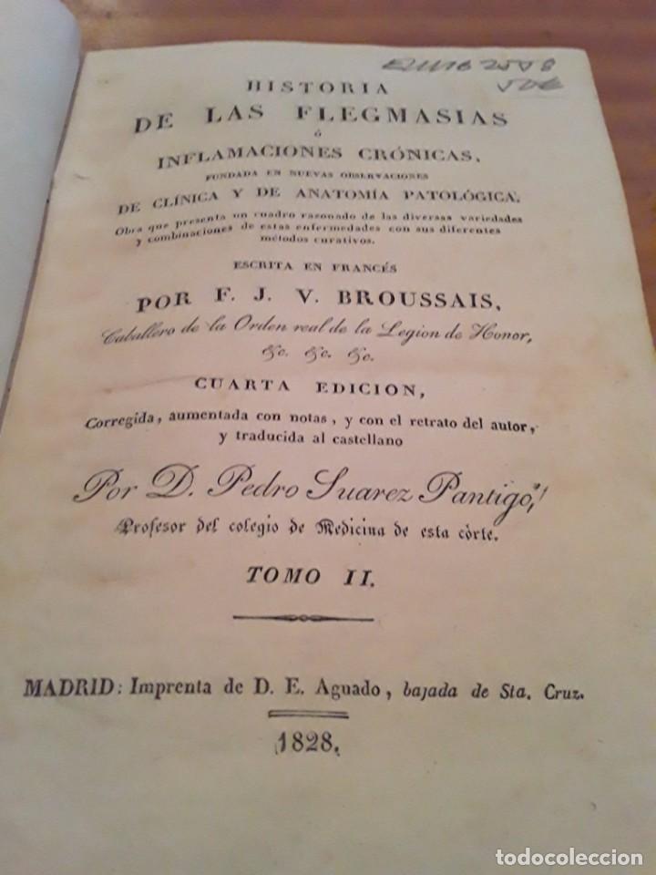 Libros antiguos: HISTORIA DE LAS FLEGMASIAS O INFLAMACIONES CRONICAS.F.J.V.BROUSSAIS.T II.IMP.D.E.AGUADO.1828.312 P. - Foto 2 - 297155903