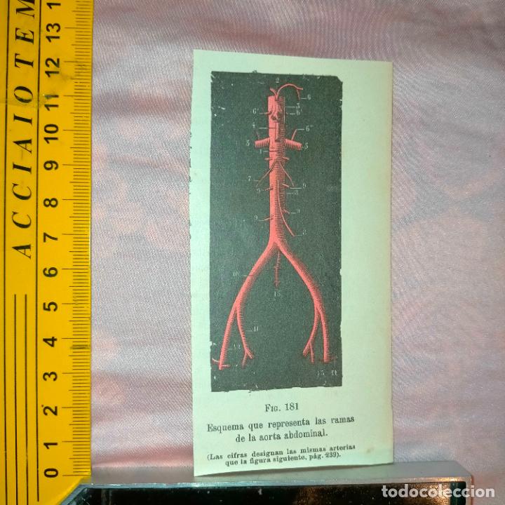 Libri antichi: antiguo grabado cuerpo humano medicina a&ntilde;o 1900 medico - PARTES ANATOMIA DISECCION VER FOTOS