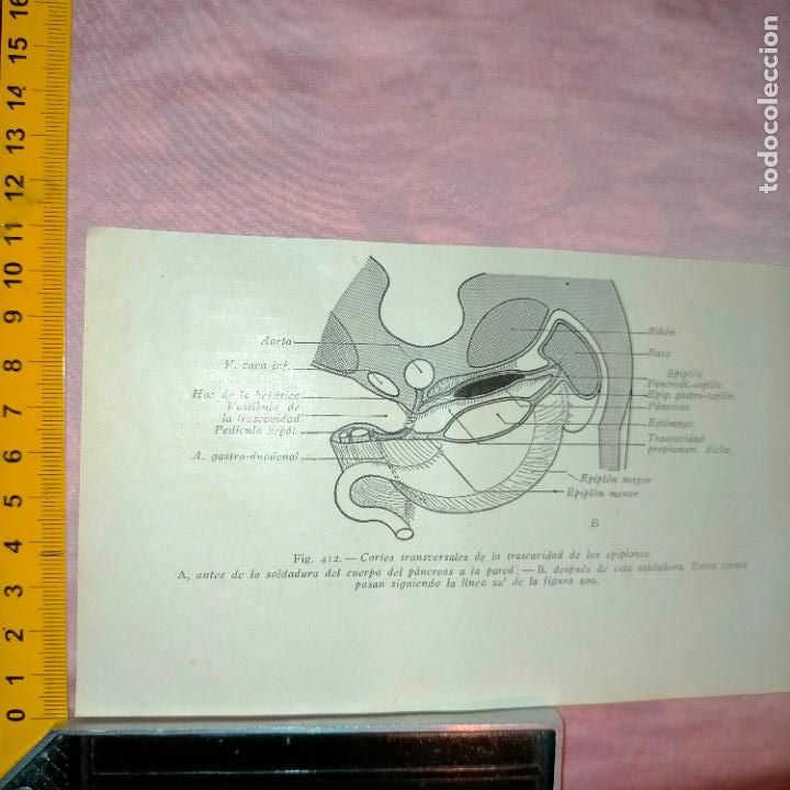 Libri antichi: antiguo grabado cuerpo humano medicina a&ntilde;o 1900 medico - PARTES ANATOMIA DISECCION VER FOTOS