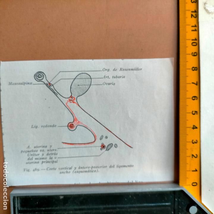 Antiquarische B&uuml;cher: antiguo grabado cuerpo humano medicina a&ntilde;o 1900 medico - PARTES ANATOMIA DISECCION VER FOTOS