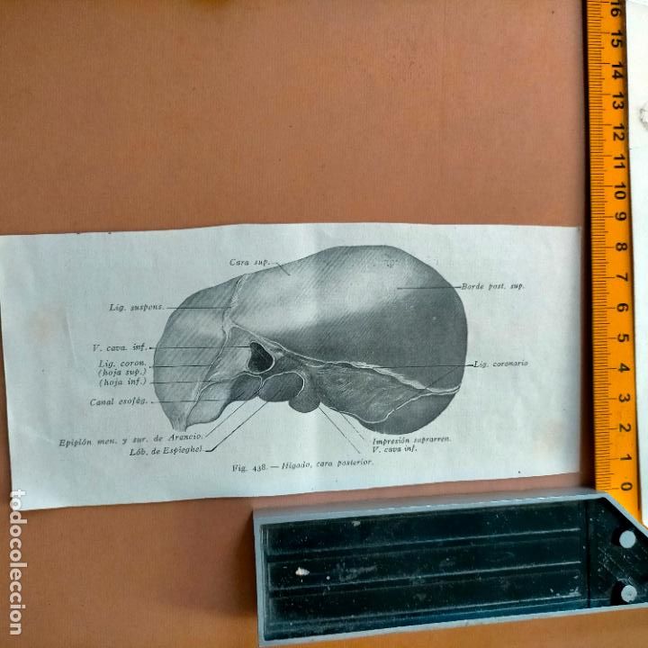 Antiquarische B&uuml;cher: antiguo grabado cuerpo humano medicina a&ntilde;o 1900 medico - PARTES ANATOMIA DISECCION VER FOTOS