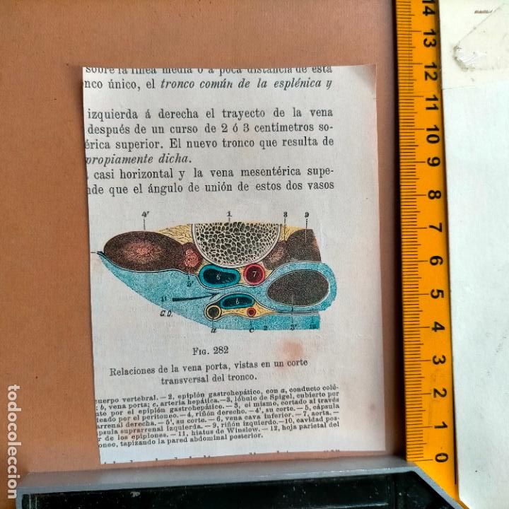 Libri antichi: antiguo grabado cuerpo humano medicina a&ntilde;o 1900 medico - PARTES ANATOMIA DISECCION VER FOTOS