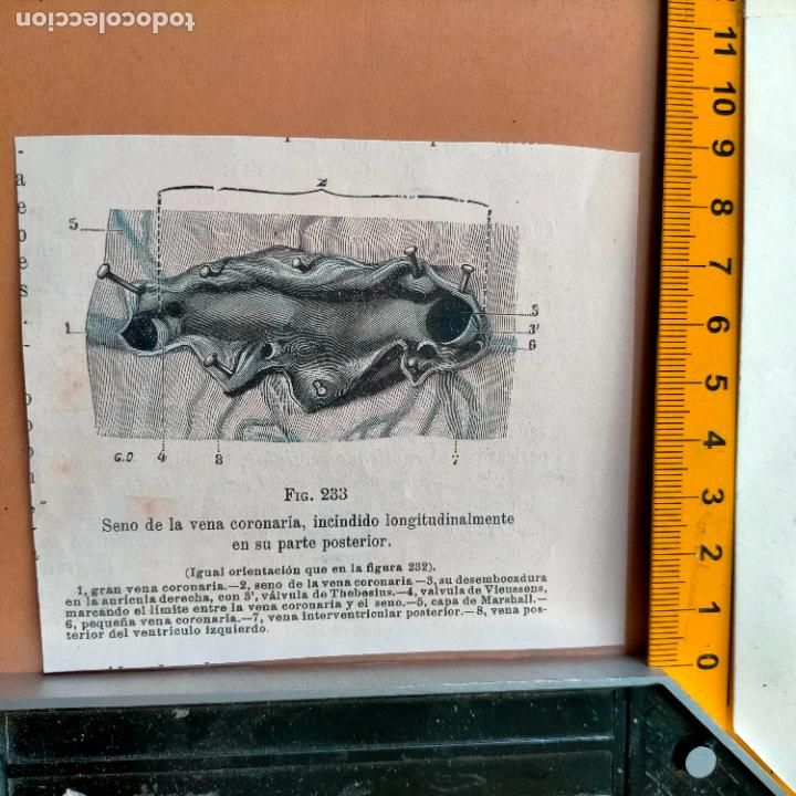 Libri antichi: antiguo grabado cuerpo humano medicina a&ntilde;o 1900 medico - PARTES ANATOMIA DISECCION VER FOTOS