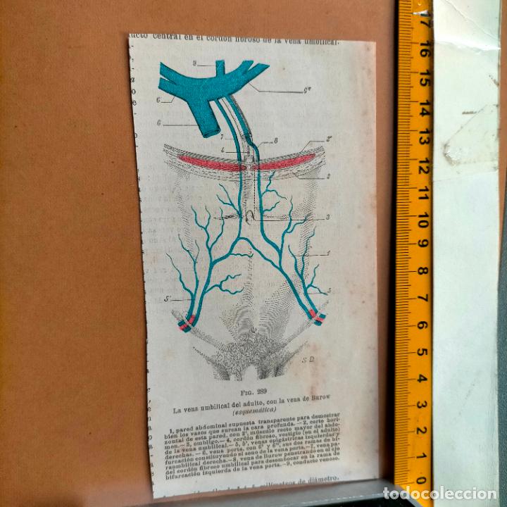 Libri antichi: antiguo grabado cuerpo humano medicina a&ntilde;o 1900 medico - PARTES ANATOMIA DISECCION VER FOTOS