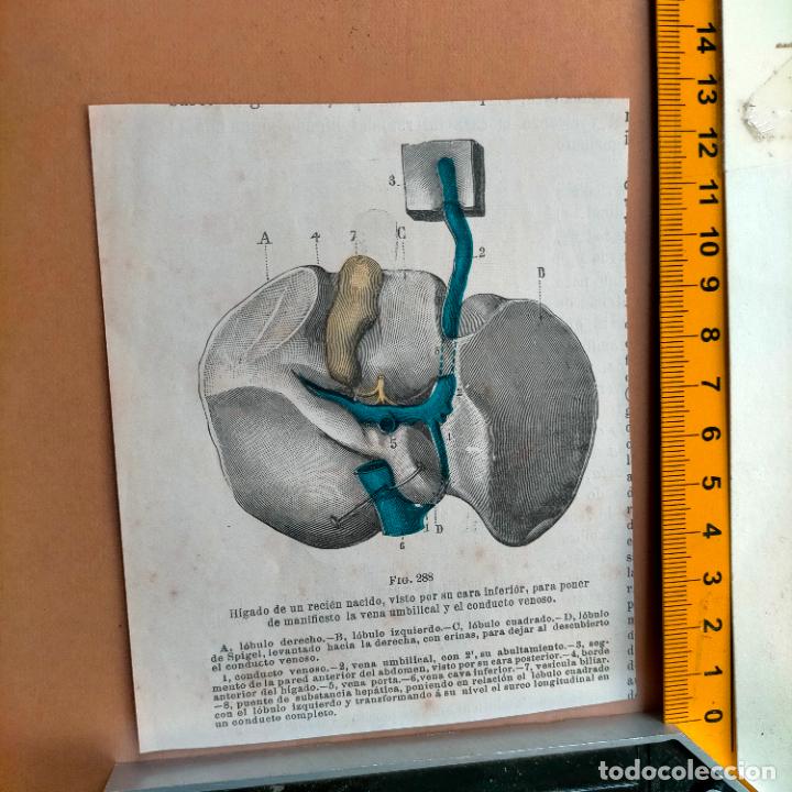Libri antichi: antiguo grabado cuerpo humano medicina a&ntilde;o 1900 medico - PARTES ANATOMIA DISECCION VER FOTOS